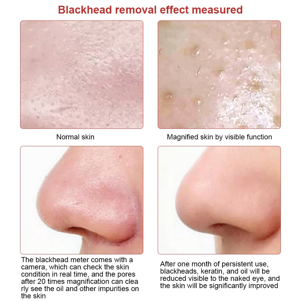 Visible Camera Blackhead Remover Face Deep Nose Cleaner Pore Acne Pimple Removal Vacuum Suction Facial Beauty Clean Skin Tool